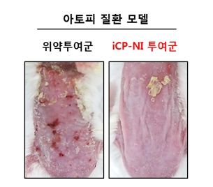 면역염증치료신약 iCP-NI를 아토피 피부염 질환모델에 피하주사 투여 시 치료 효능. 사진=셀리버리