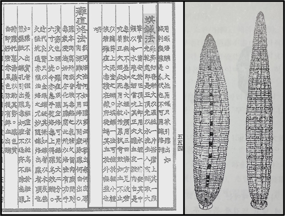 동의보감에 기록된 기침법(蜞鍼法, 거머리침법)과 약용동물학에 그려진 말거머리(왼쪽)와 참거머리 그림.