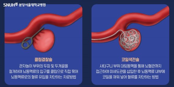 (분당서울대병원 제공)