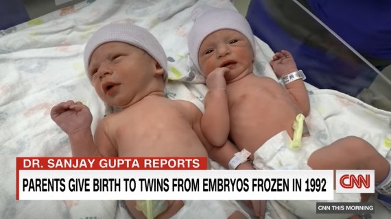30년 된 냉동 배아서 쌍둥이 탄생, 기증자의 정체는..