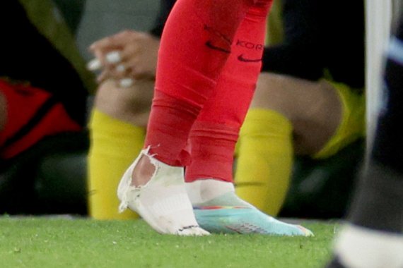 [2022 카타르] '마스크 투혼' 손흥민, 밟히고 양말까지 찢겼다