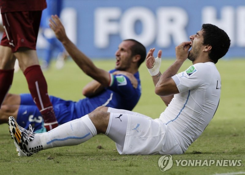 2014년 브라질 월드컵에서 키엘리니 물어버린 수아레스 FILE - Uruguay's Luis Suarez holds his teeth after colliding with Italy's Giorgio Chiellini's shoulder during the group D World Cup soccer match between Italy and Uruguay at the Arena das Dunas in Natal, Brazil on June 24, 2014. (AP Photo/Ricardo Mazalan, File) FILE PH
