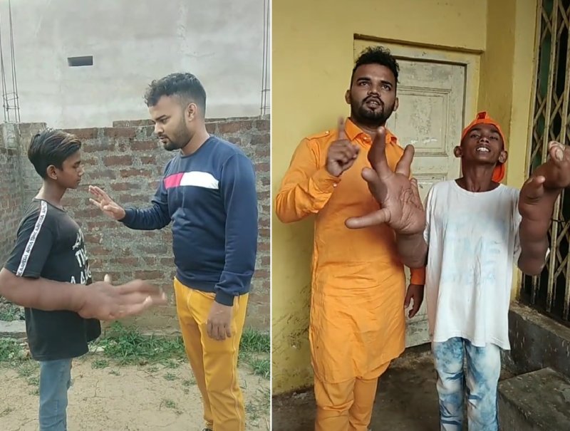 [서울=뉴시스] 자신의 손을 있는 그대로 받아들이기로 한 칼렘은 소셜미디어(SNS)를 통해 적극적인 활동에 나섰다 (사진출처: 인스타그램, 틱톡 영상 캡처) 2022.12.13. *재판매 및 DB 금지