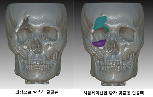 고려대학교의료원 제공.