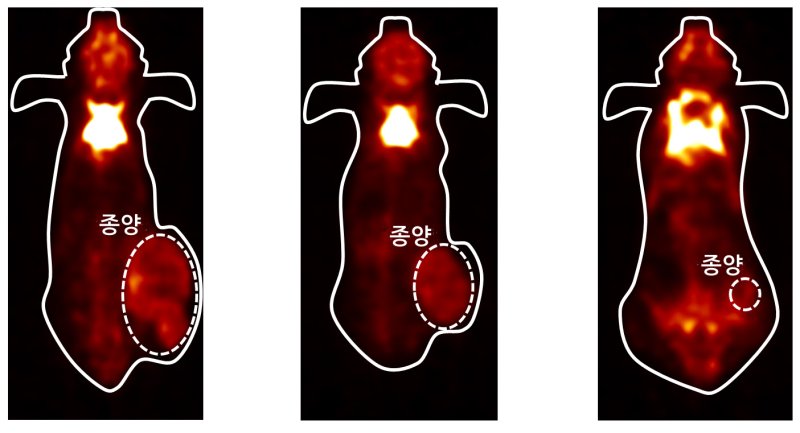 원자력연구원 박정훈 박사팀이 새로 개발한 나노물질(왼쪽)이 실험쥐에 있는 15~20㎣ 크기의 대장암조직을 3㎣까지 작게 만들었다. 다른 물질을 주입한 실험쥐에서는 대장암 조직이 450㎣(오른쪽)와 99㎣까지 커졌다. 원자력연구원 제공
