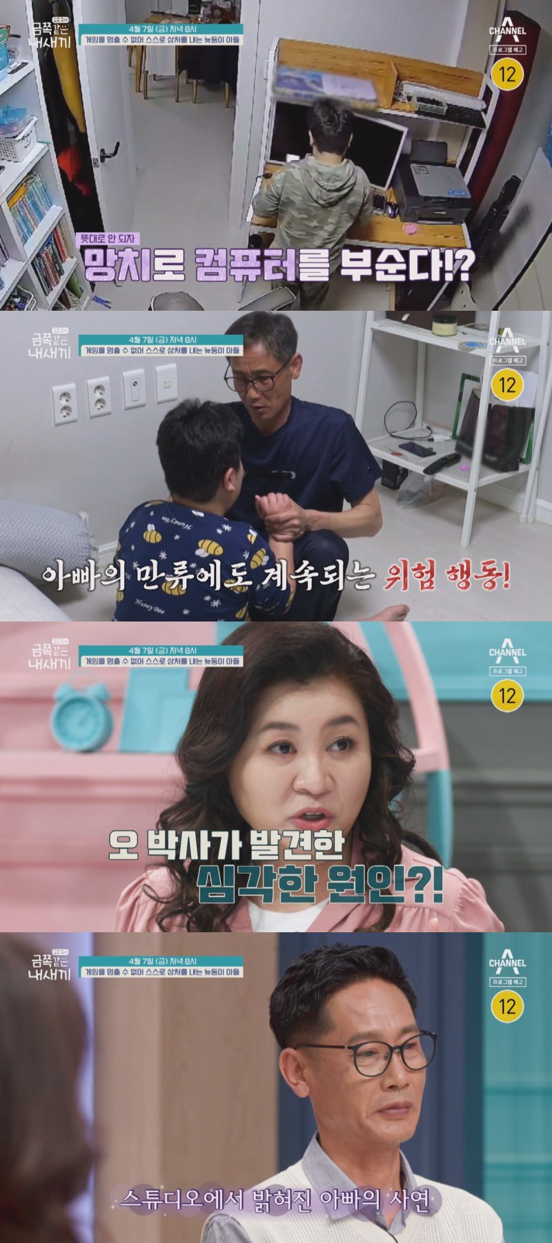 엄마 잃은 금쪽이, 게임중단하면 분노+위험행동…돌연 포옹 요구까지