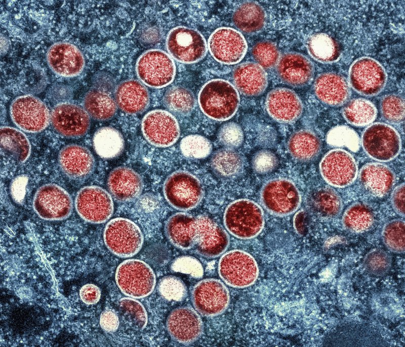 미국 국립알레르기감염병연구소(NIAID)가 제공한 이미지. 투과전자현미경으로 감염된 세포(파란색) 내 엠폭스 입자(빨간색)가 보이고 있다. 뉴시스 제공.
