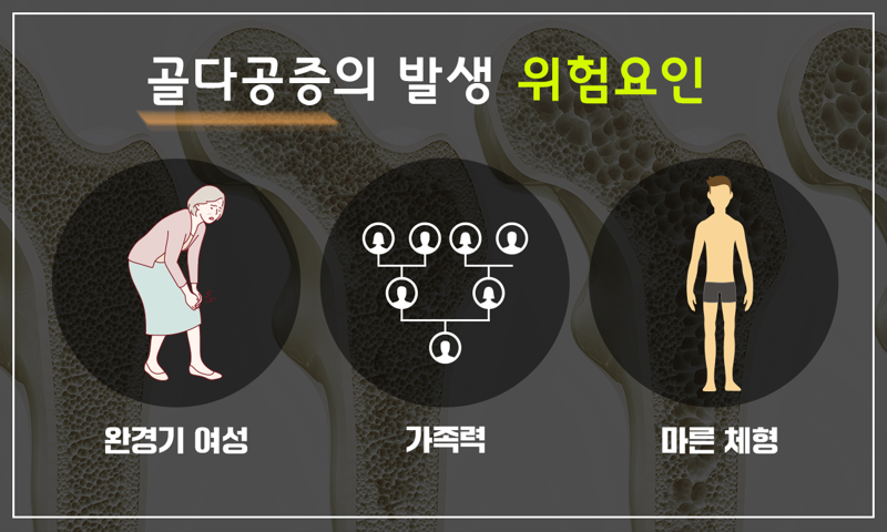 나누리병원은 14일 골다공증에 특히 주의해야하는 사람들의 유형으로 완경기 여성, 가족력, 마른체형을 꼽았다. 나누리병원 제공