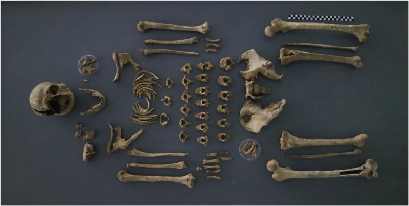 DMZ서 발굴 故 전복희 하사 "25세 때 전사, 72년 만에 가족 품으로"