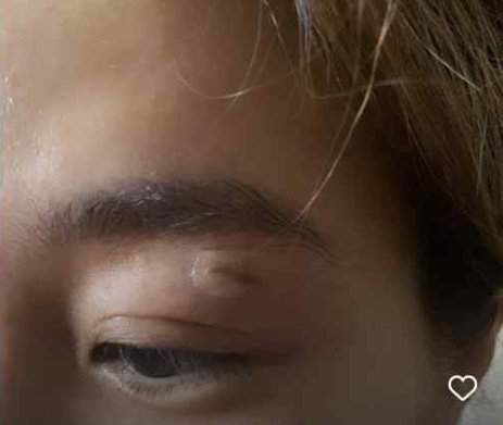 옥주현, 일본서 눈가 부상 신나게 돌진하다 유리창에 박아