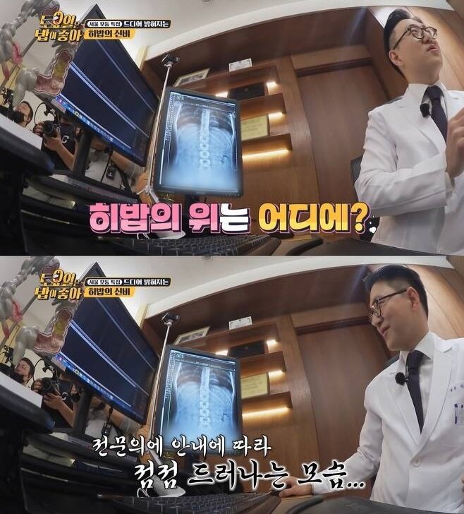 '식비 월1천만원' 히밥 '위' 공개…"배꼽까지 늘어나, 장 밀어서 공간 확보"
