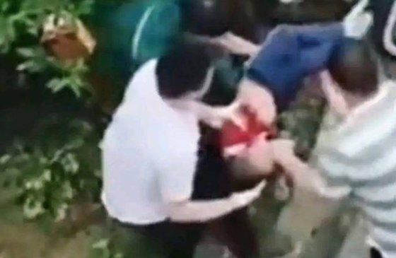 26층에서 뛰어내린 아이는 다행히 골절상을 입고 생명에는 지장이 없는 것으로 전해졌다. 추락한 아이를 이송하는 모습. 웨이보 캡처
