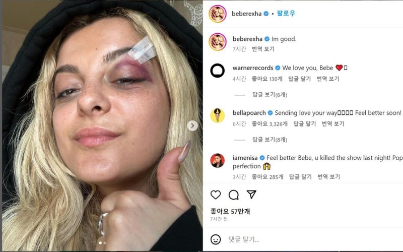 사진=비비 렉사(Bebe Rexha) 인스타그램 캡처, 연합뉴스