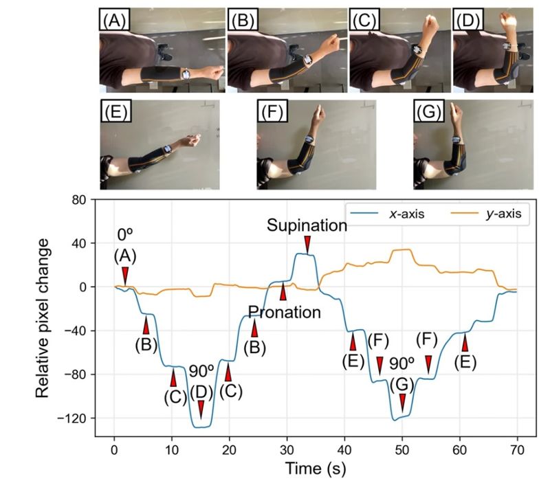 포항공과대(POSTECH) 연구진이 개발한 컴퓨터 비전 기반의 광학 스트레인(CVOS) 센서가 재활 치료용 신체 보조기에 적용돼 복잡한 팔 움직임을 실시간으로 감지해냈다. POSTECH 제공