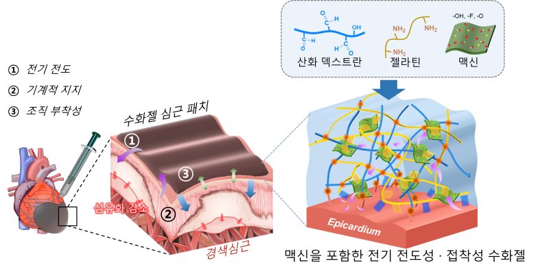 심장에 바를 수 있는 전기전도성·접착성 수화젤 심근 패치 모식도(지스트 제공)/뉴스1