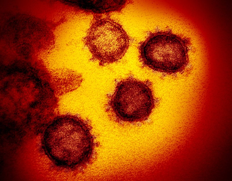 미국 국립보건원(NIH)이 전자현미경으로 관찰한 코로나19 바이러스의 모습. AP뉴시스