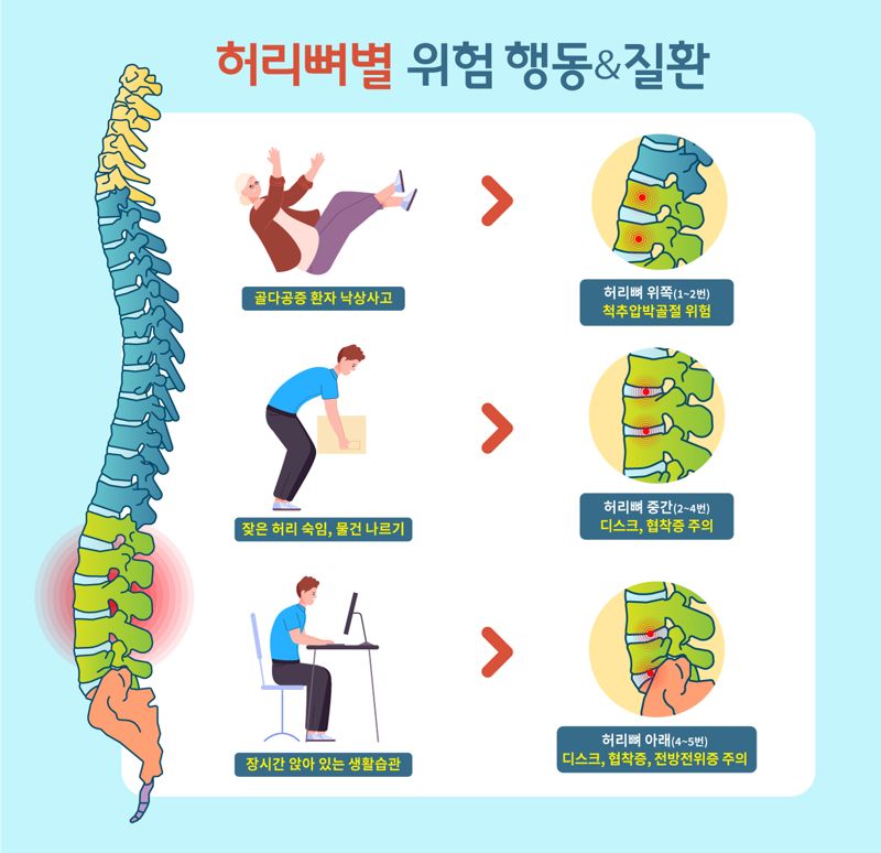 허리뼈별 위험행동 및 질환. 주안나누리병원 척추센터 제공