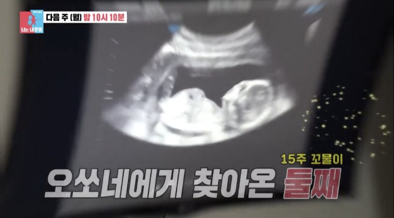 오상진♥김소영, 둘째 임신…축복 속 부부싸움 왜?