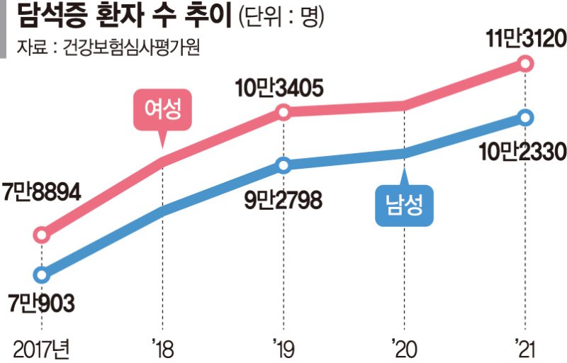 명치·오른쪽 윗배 통증 담석증이 보내는 '신호'