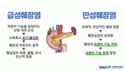 [위클리 건강] "극심한 복통 부르는 '췌장염'…60%는 과음이 원인"