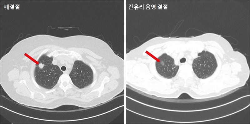 (은평성모병원 제공)