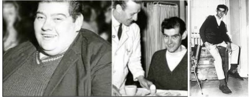 1966년 6월, 33살 먹은 영국 스코틀랜드의 앵거스 바비에리가 207㎏에 초고도 비만을 해결하기 위해 의료진의 철저한 지도아래 무려 292일간 단식, 125㎏을 감량해 완전히 다른 사람으로 재탄생했다. ⓒ 뉴스1 DB