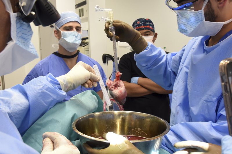 미 메릴랜드 의대 외과 의사들이 지난 20일 58살의 로렌스 포셋에게 사상 2번째 인간에 대한 돼지 심장 이식 수술을 준비하고 있다.<div id='ad_body2' class='ad_center'></div> /사진=뉴시스