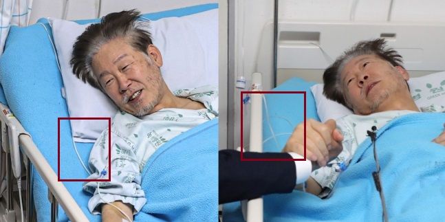 단식 23일째를 맞이한 이재명 더불어민주당 대표가 22일 서울 중랑구 녹색병원에서 진교훈 강서구청장 후보 등과 대화를 하는 모습(왼쪽)과 그 전날인 21일 오전 박광온 더불어민주당 원내대표와 입원실에서 손을 잡은 모습. 이 대표의 팔에 꽂혀 있는 링거 수액줄의 색깔이 확연이 다른 것을 보여주고있다. 일부 의사들은 22일 사진에 보이는 이 대표의 수액줄이 투명하지 않고 하얀색이라는 점을 들어 이것이 인체에 필요한 하루 영양소가 모두 들어있는 'TPN'이라고 주장했다. 뉴스1