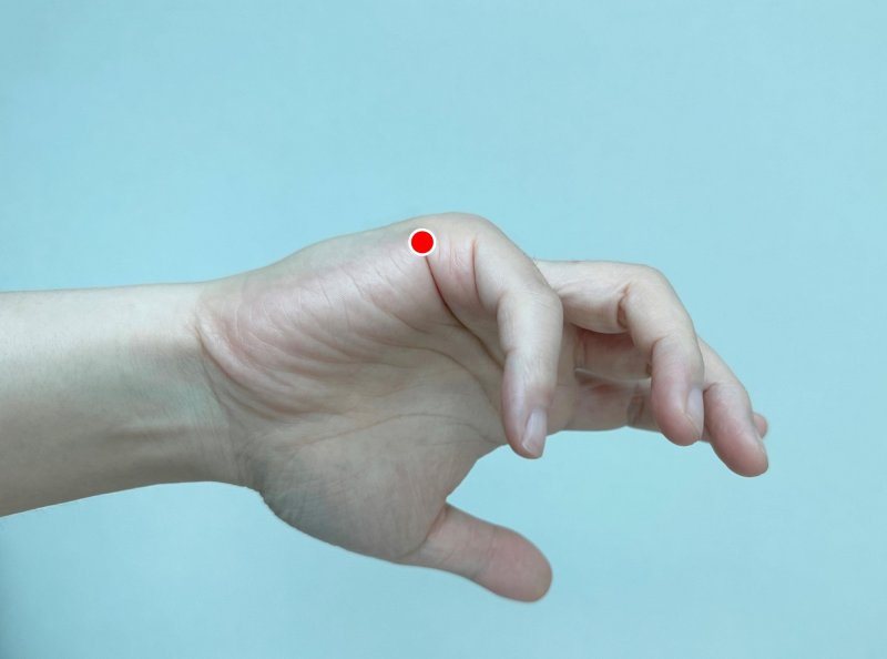 후계혈(後谿穴). (대전자생한방병원 제공) /뉴스1