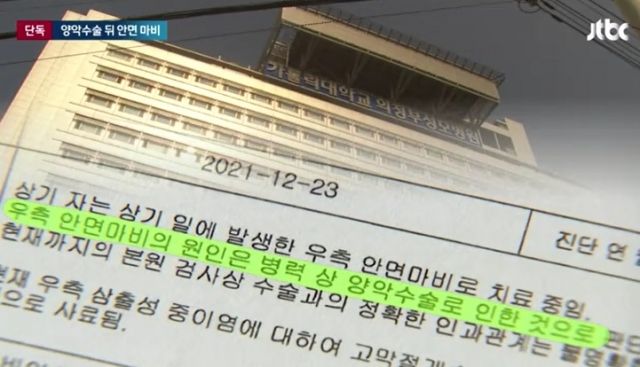강남 성형외과 수술 후기 "까만 피가.." 안면마비?