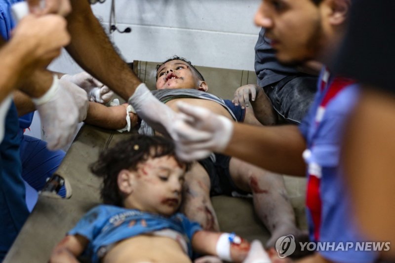 이스라엘 공습으로 다친 팔레스타인 가자지구 아이들 Children injured in an Israeli strike receive emergency medical care at the Al-Shifa hospital in Gaza City on October 15, 2023. Israel embarked on a withering air campaign against Hamas militants in Gaza after they carried out a brutal attack on Israel on October 7 that l