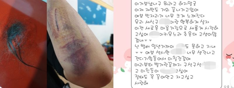 가정폭력 당시 뽑힌 머리카락과 상처입은 팔(왼쪽), 전 남편이 보낸 카톡 메시지. 연합뉴스, A씨 제공