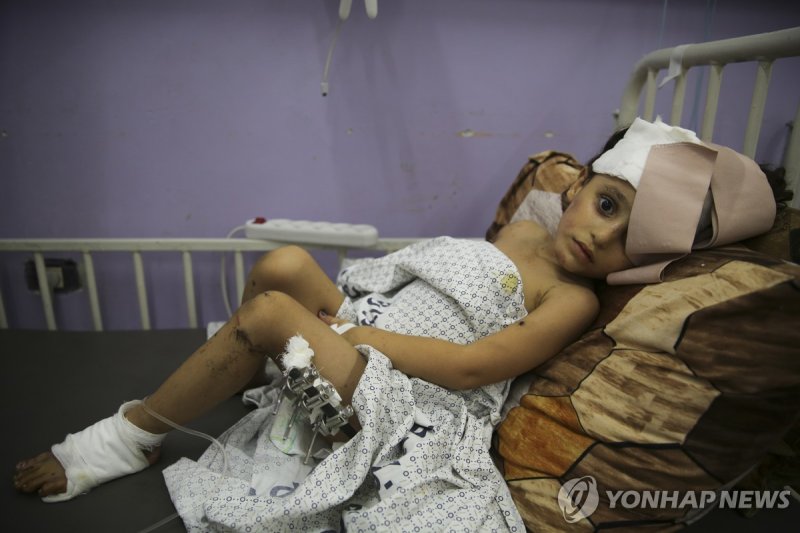 가자지구 병원의 절규 "제왕절개‧두개골 수술 마취제 없이..."