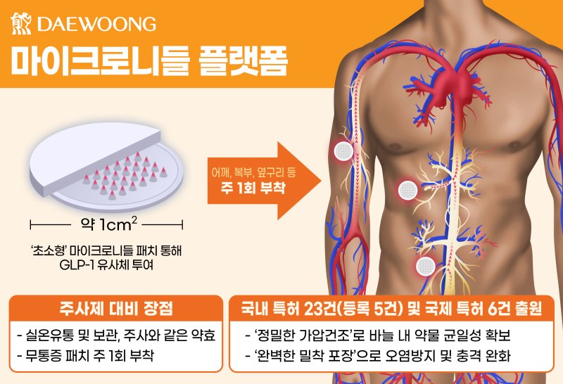 대웅제약 마이크로니들 플랫폼 기술 개요. 대웅제약 제공.