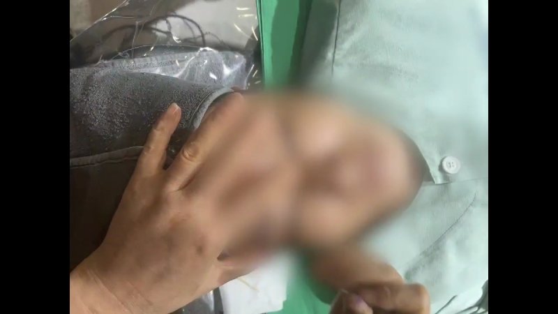 불법 성형수술 장면. 부산경찰청 제공