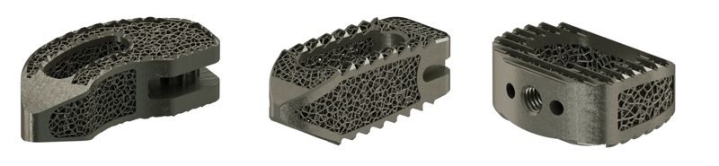  오스테오닉, 자체 기술로 개발한 '3D 프린팅 티타늄' 척추 임플란트 본격 출시