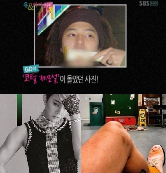 일부 팬들이 공개한 지드래곤의 평소 제모 증거들. 출처=SBS, MBC 방송화면 캡처, 엘르 화보