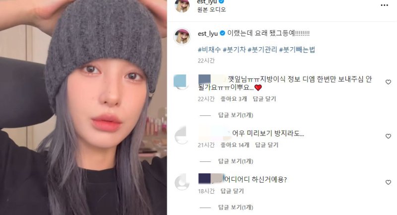 '이렇게 변했어요'…유깻잎, 안면윤곽술 후 근황 공개
