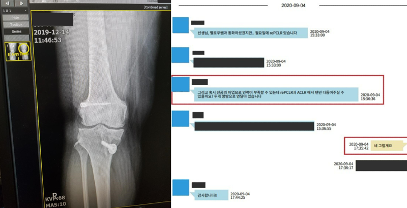 식약처 승인을 받지 않은 '반쪽 아킬레스건'을 수입·유통해 요양급여 100억여원을 편취한 피의자 85명이 붙잡혔다. 사진은 왼쪽부터 수술에 이용된 미승인 아킬레스건과 의료기기 납품업체 영업직원에게 환자에 맞게 아킬레스건을 대신 다듬어달라고 부탁하는 연락 내용 /사진=서울경찰청 제공