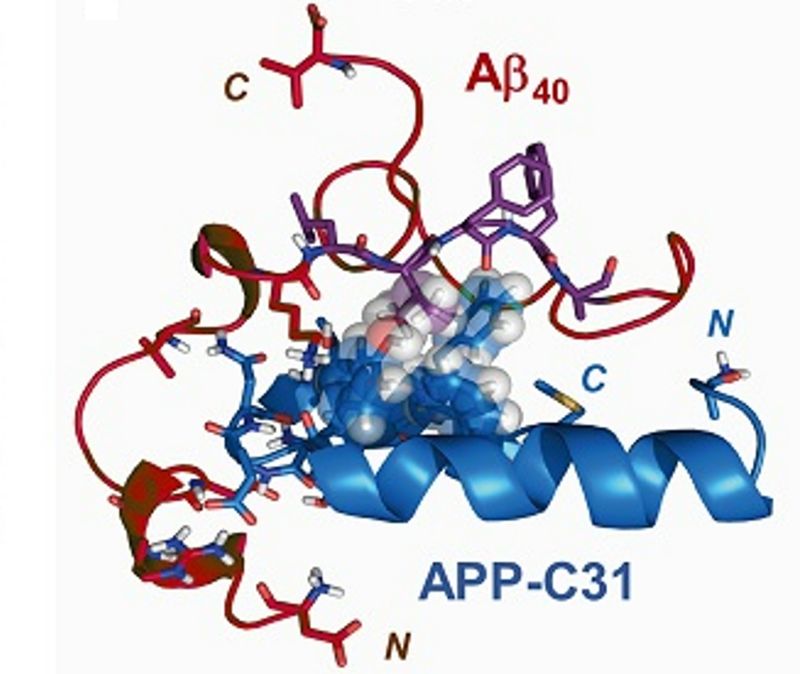 알츠하이머병 일으키는 단백질을 찾아냈다