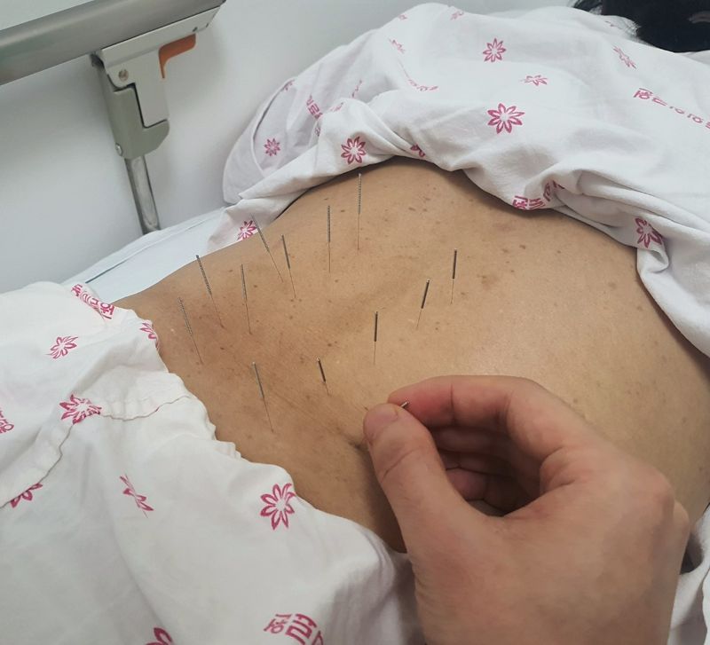 한국한의학연구원 연구진이 요통환자에 침을 놓고 있다. 한의학연구원 제공