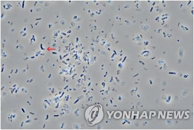 감정 시험에서 대웅제약의 보툴리눔 균주가 포자를 생성한 모습 [대웅제약 제공]