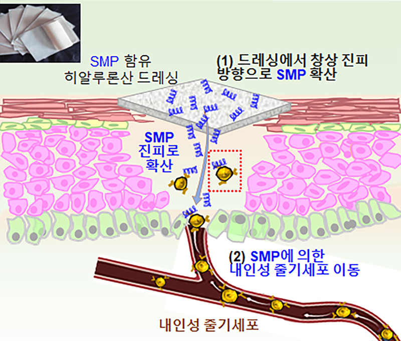 아주대 공동 연구팀, 내인성 줄기세포 활용 '피부 상처 치료 방안' 개발