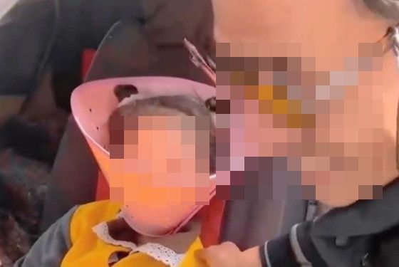 한 남성이 손녀에게 반려동물용 목 깔때기를 착용시킨 모습 / 웨이보 갈무리
