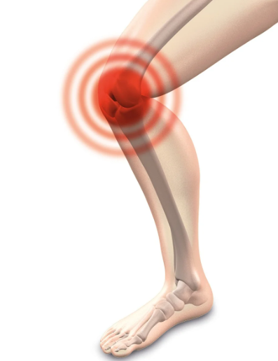 무릎 관절 사이에는 반월상연골판은 무릎관절의 뼈 사이에서 압력이나 충격을 흡수해 뼈를 보호하고 관절의 움직임을 부드럽게 도와주는 역할을 한다. 추운 날씨에 손상 우려가 있어 주의가 요구된다.