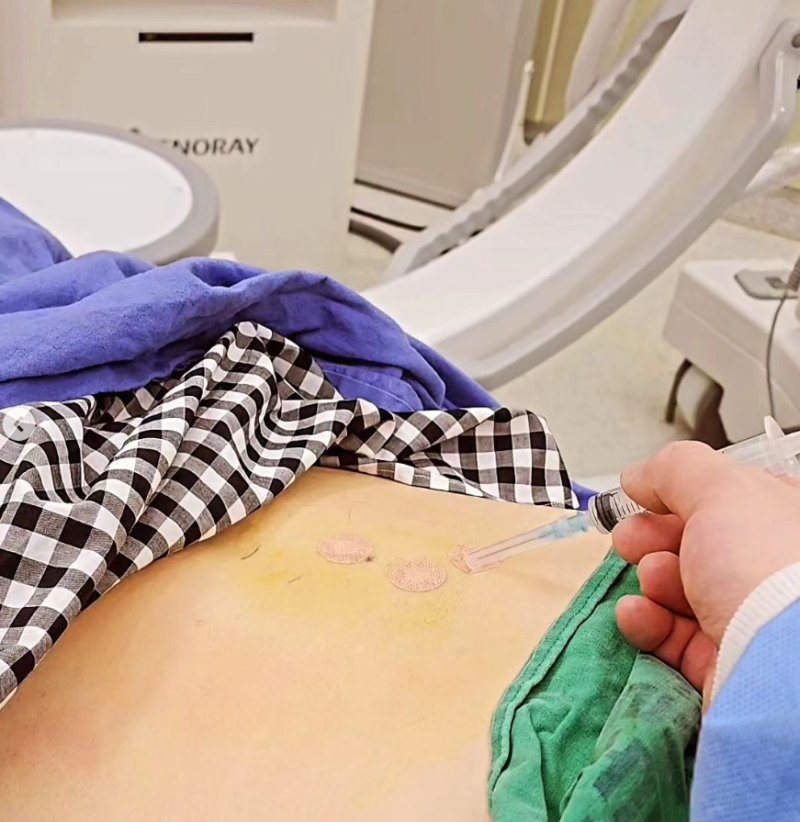 [서울=뉴시스] 방송인 노홍철이 허리 치료를 받고 있는 모습을 공개했다. (사진=노홍철 인스타그램 캡처) 2023.12.21. photo@newsis.com *재판매 및 DB 금지