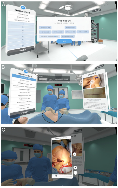 분당서울대병원 제왕절개술 VR시뮬레이션 화면. 분당서울대병원 제공