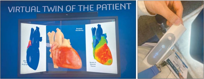 다쏘시스템의 디지털 트윈 기술을 응용한 3차원(3D) 심장 설명 영상(왼쪽 사진). 오른쪽은 위딩스의 심전도기, 산소포화도측정기, 청진기, 체온계의 역할을 한번에 하는 '빔오' 체험 모습 사진=김준석 기자