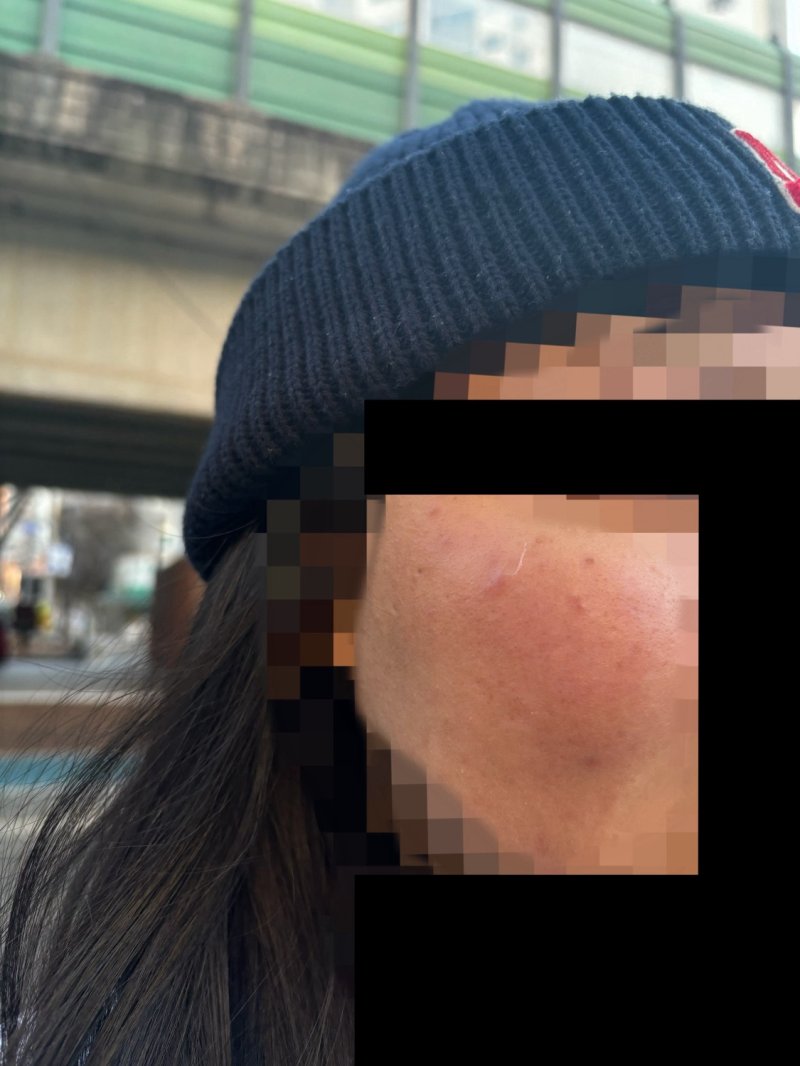 외국인 유학생이 지난 12일 오후 동대문구 휘경동에서 일면식도 없는 남성에게 묻지마 폭행을 당했다. / 뉴시스