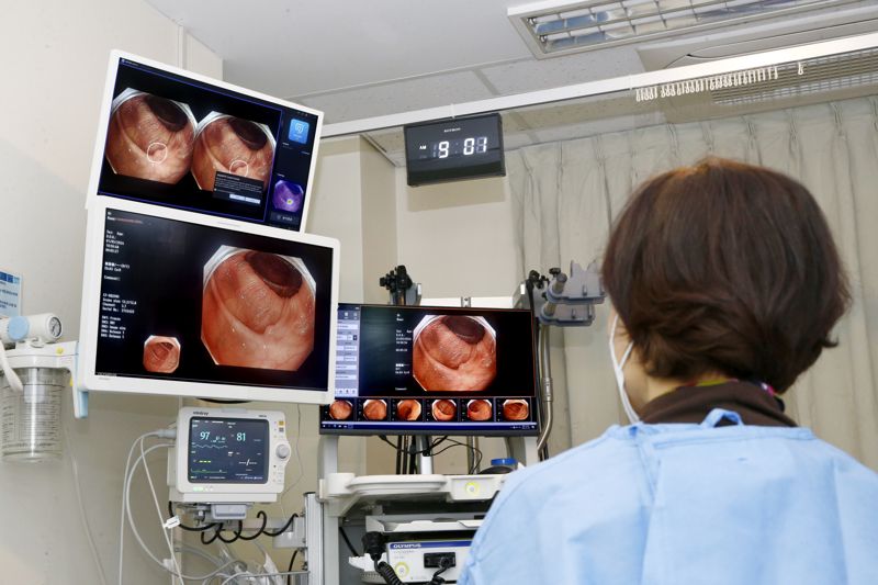 최근 도입된 인공지능 실시간 내시경 영상분석 시스템을 활용하고 있는 의료진. /일산병원 제공